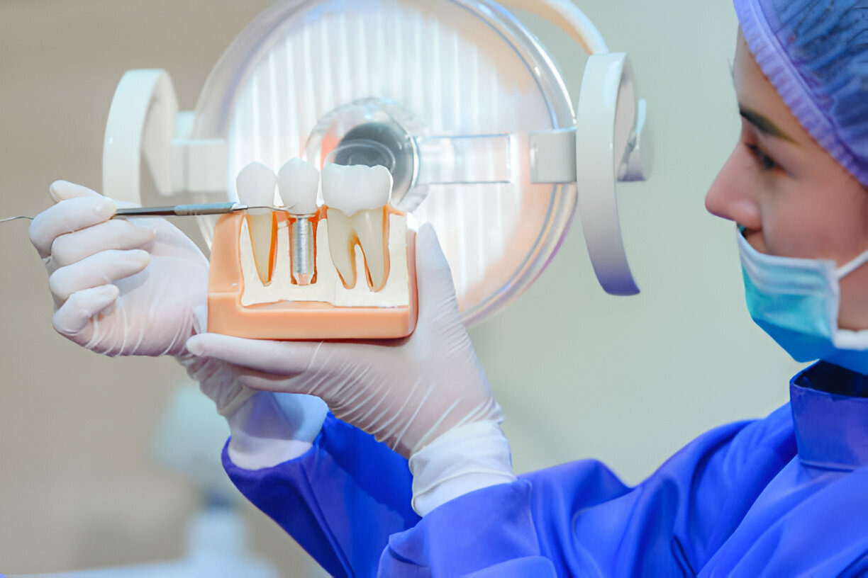 Dental Implant Risks: Common Issues and Their Solutions_1