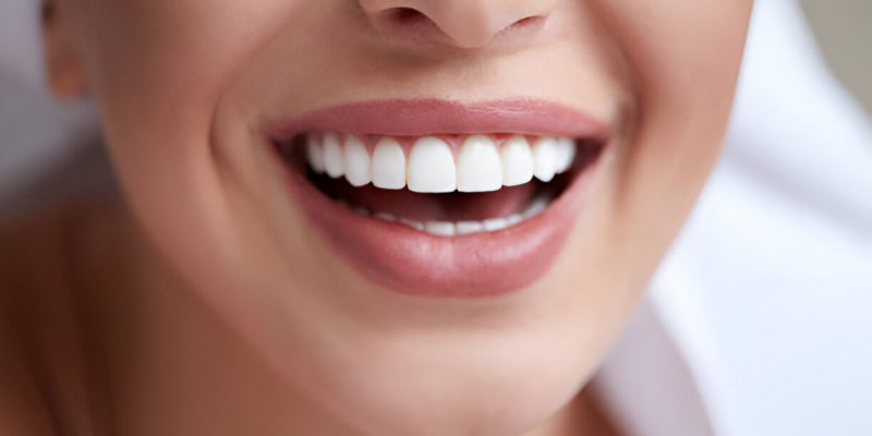 Navarro Dental Corsicana TX: Your Trusted Clinic for Teeth Whitening in Texas_FI