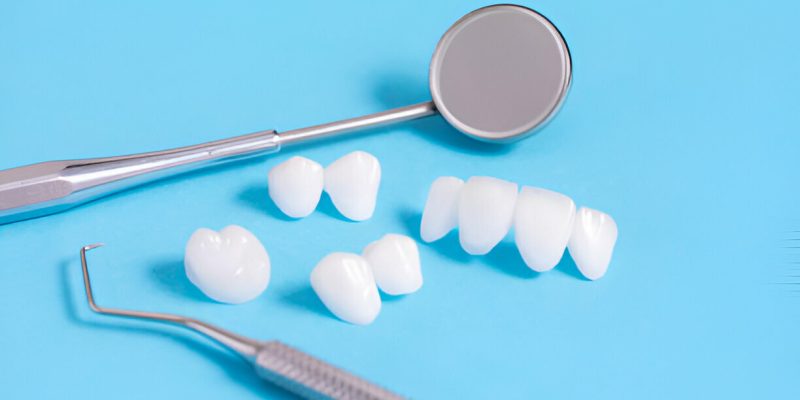 Transform Your Smile with Porcelain Crowns at Navarro Dental Center: Trusted Dentists in Corsicana, TX_FI